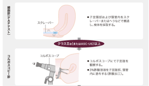【画像】子宮頸検査えっwwwwwwwwwwwww